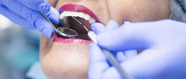 Best Emergency Dental Services for Seniors in Garfield, NJ